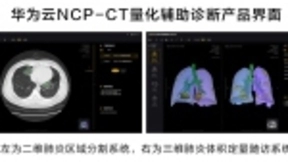 华为云推出新冠肺炎AI辅助诊断服务，CT量化结果秒级输出