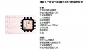人工智能在心电图中的应用：优势和缺陷并存