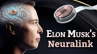 马斯克Neuralink启动全球试验招募，微美全息脑机接口技术突破新里程碑